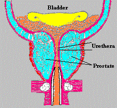 prostate2.gif (20127 bytes)